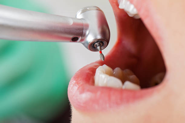 Professional Emergency Dental Service in GA